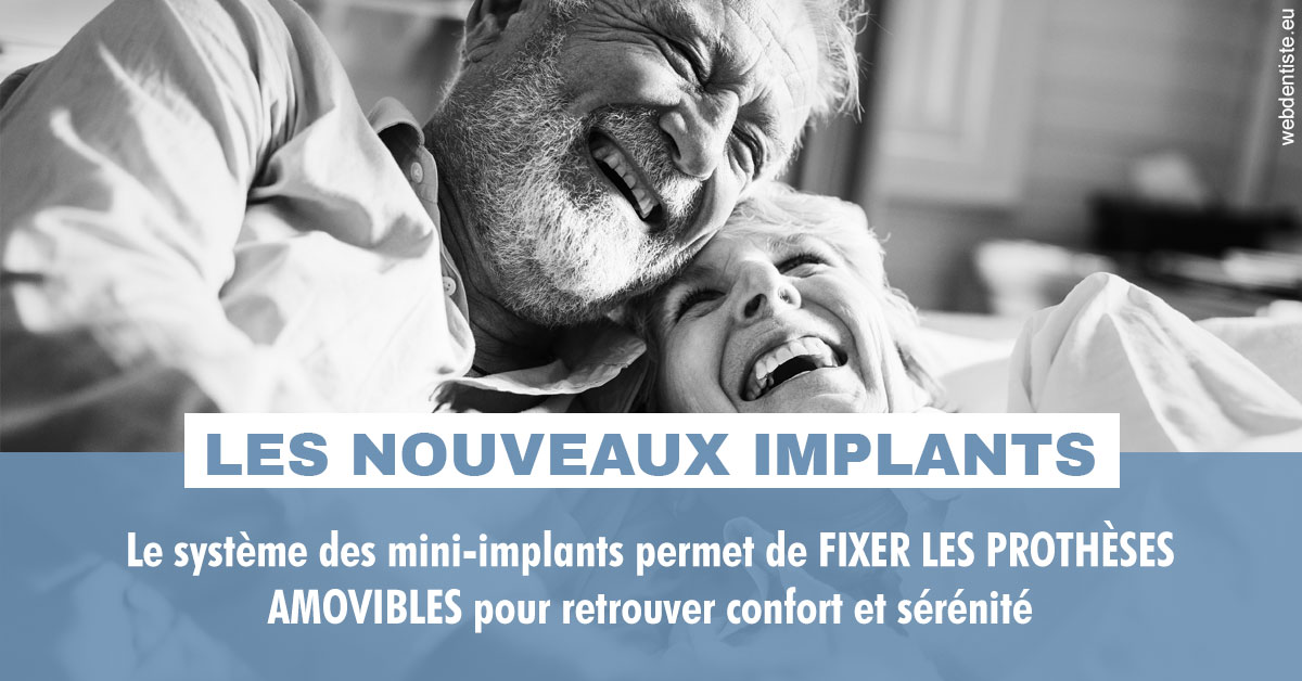 https://www.centredentaireleluc.fr/Les nouveaux implants 2