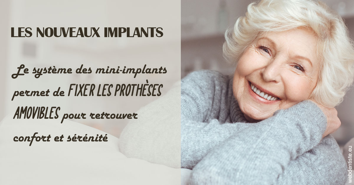 https://www.centredentaireleluc.fr/Les nouveaux implants 1