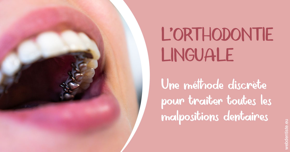 https://www.centredentaireleluc.fr/L'orthodontie linguale 2