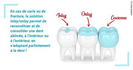 https://www.centredentaireleluc.fr/L'INLAY ou l'ONLAY