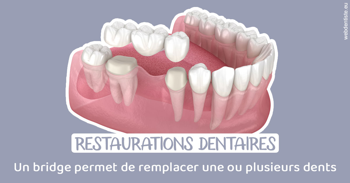 https://www.centredentaireleluc.fr/Bridge remplacer dents 1