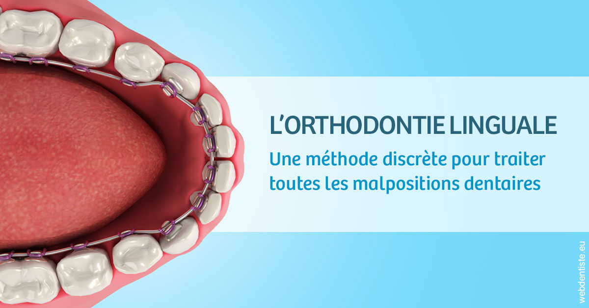 https://www.centredentaireleluc.fr/L'orthodontie linguale 1