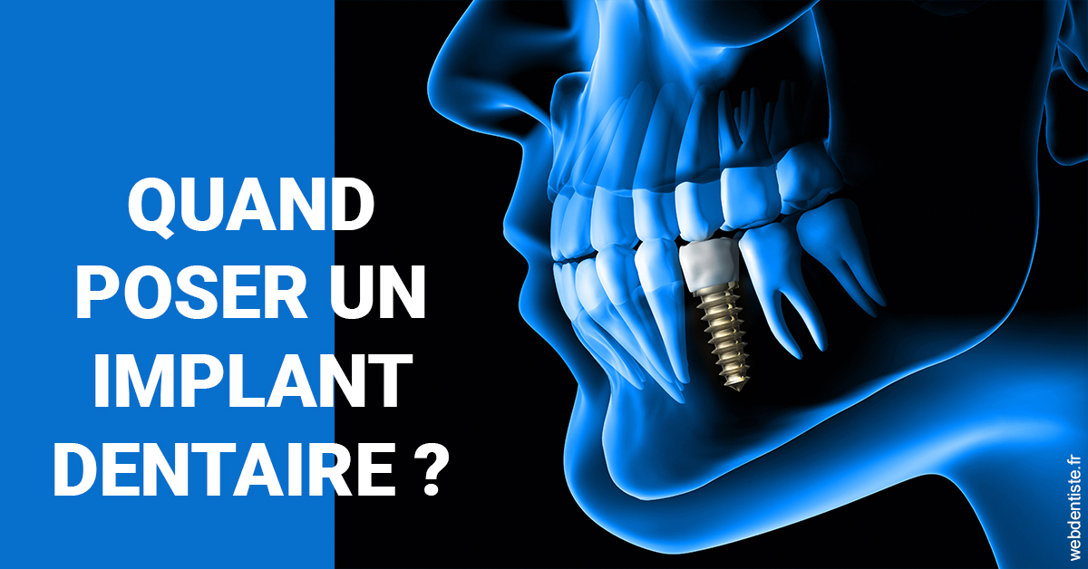 https://www.centredentaireleluc.fr/Les implants 1