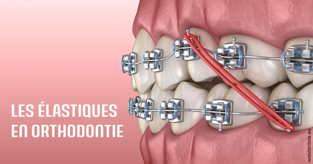 https://www.centredentaireleluc.fr/Elastiques orthodontie 2