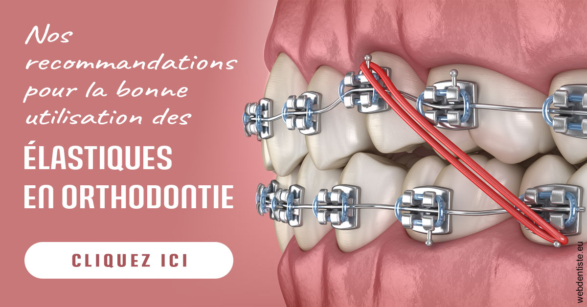 https://www.centredentaireleluc.fr/Elastiques orthodontie 2